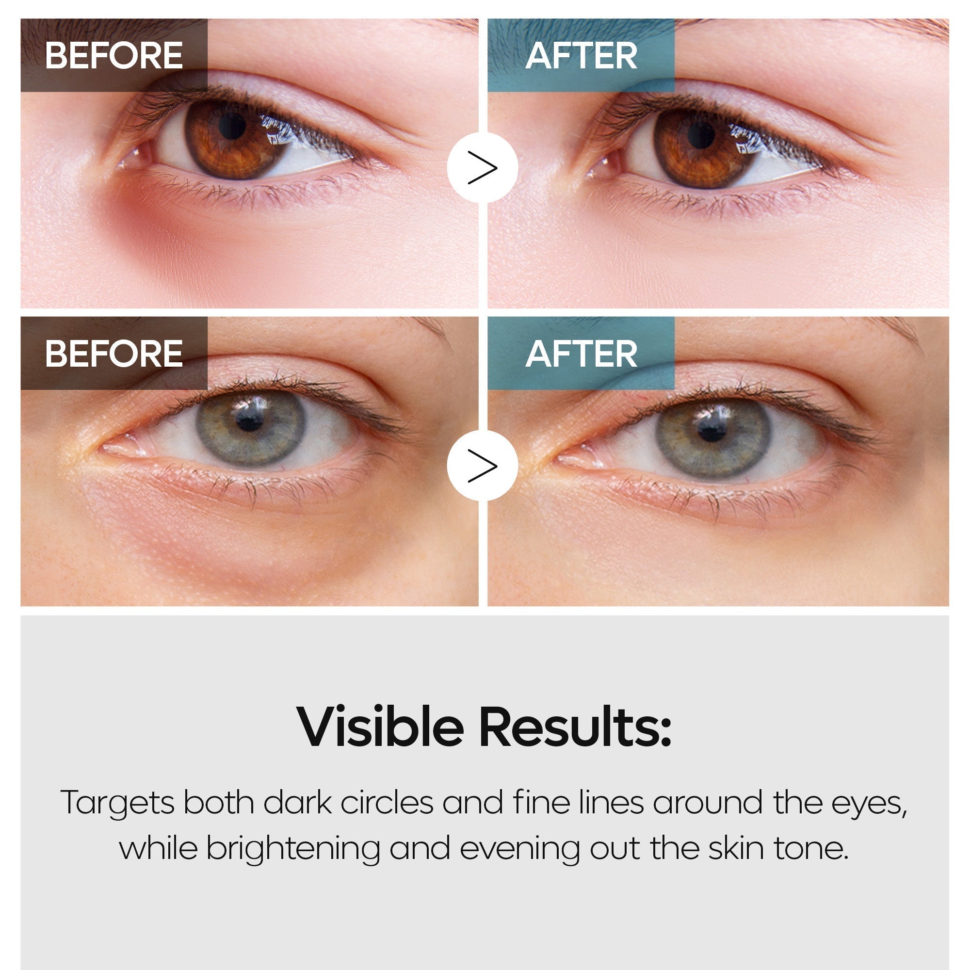 TX Eye Care Duo